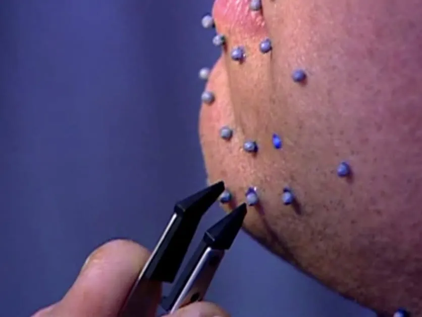 Tweezers placing facial-capture markers on a performer’s chin